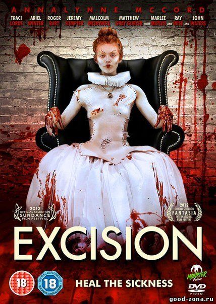 Экстирпация